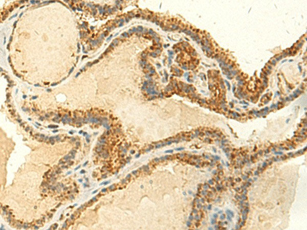 MTHFS Polyclonal Antibody Reactivity Human