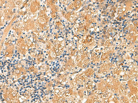 RPL13A Polyclonal Antibody Reactivity Human