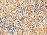RPL13A Polyclonal Antibody Reactivity Human