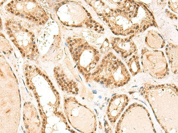 RPL13A Polyclonal Antibody Reactivity Human
