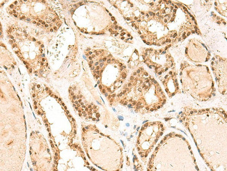 RPL13A Polyclonal Antibody Reactivity Human
