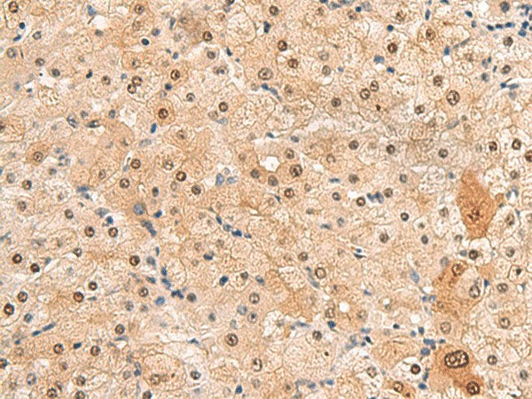 HEBP2 Polyclonal Antibody Reactivity Human