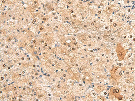 HEBP2 Polyclonal Antibody Reactivity Human