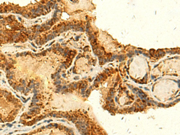 HS1BP3 Polyclonal Antibody Reactivity Human