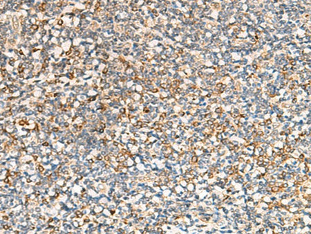 SEC22B Polyclonal Antibody Reactivity Human