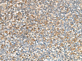 SEC22B Polyclonal Antibody Reactivity Human