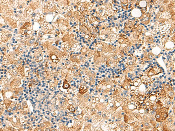 SEC22B Polyclonal Antibody Reactivity Human