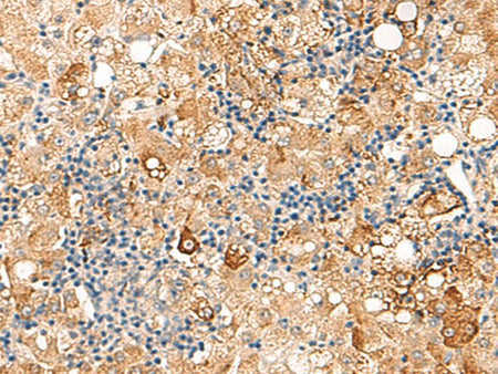 SEC22B Polyclonal Antibody Reactivity Human