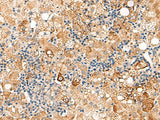 SEC22B Polyclonal Antibody Reactivity Human
