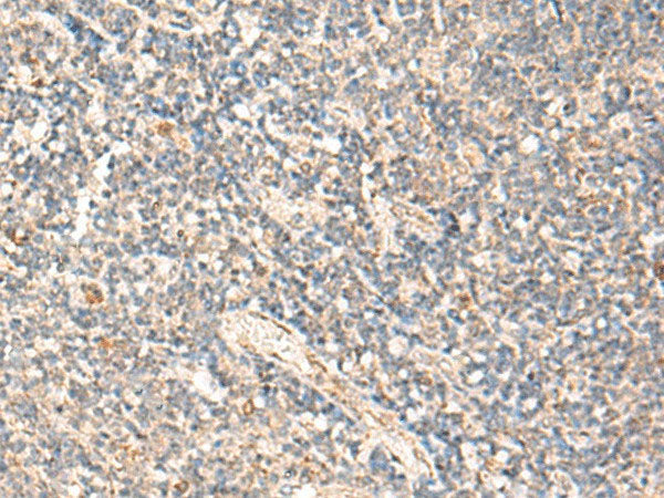 MOB1A Polyclonal Antibody Reactivity Human