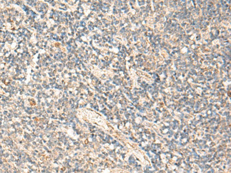 MOB1A Polyclonal Antibody Reactivity Human