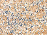 EIF3K Polyclonal Antibody Reactivity Human