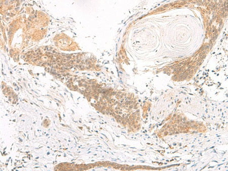 DGCR6L Polyclonal Antibody Reactivity Human