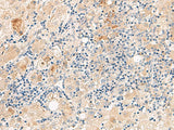 THNSL1 Polyclonal Antibody Reactivity Human