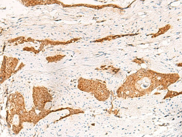 THNSL1 Polyclonal Antibody Reactivity Human