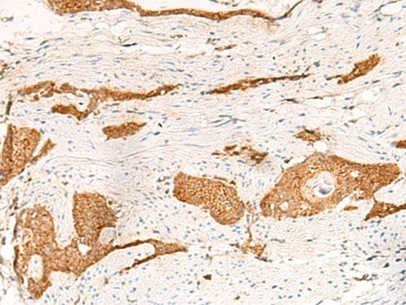 THNSL1 Polyclonal Antibody Reactivity Human