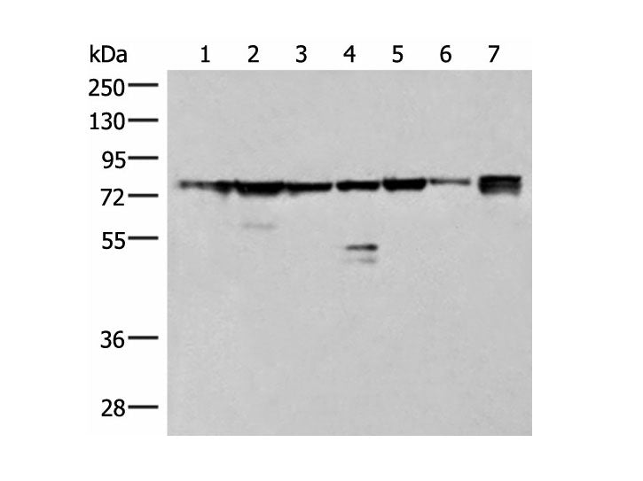 THNSL1 Polyclonal Antibody Reactivity Human