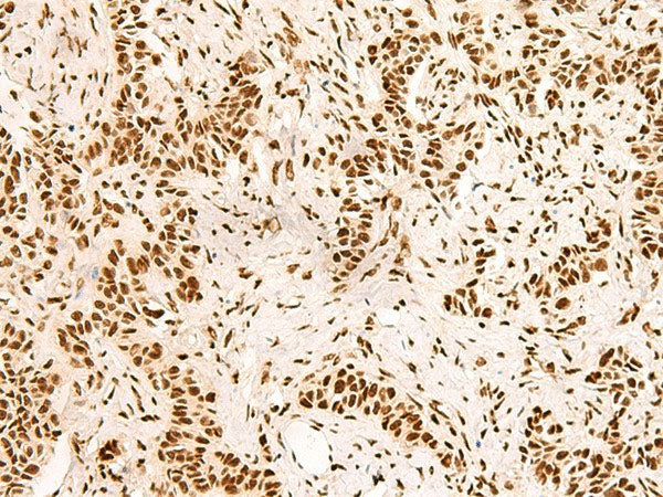 SNRPB2 Polyclonal Antibody Reactivity Human