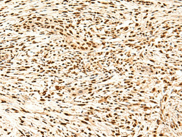 SNRPB2 Polyclonal Antibody Reactivity Human