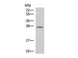 SNRPB2 Polyclonal Antibody Reactivity Human