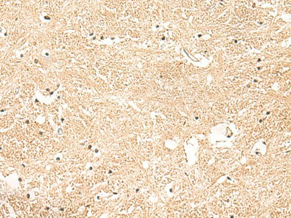 GSTK1 Polyclonal Antibody Reactivity Human