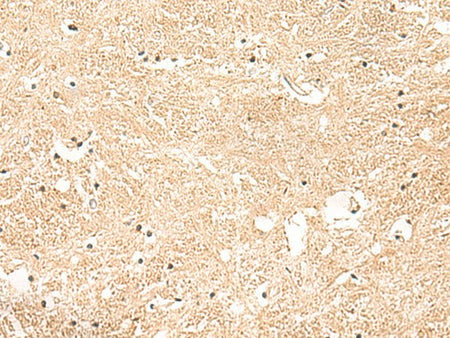 GSTK1 Polyclonal Antibody Reactivity Human