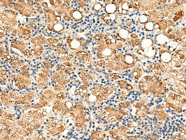 NEGR1 Polyclonal Antibody Reactivity Human