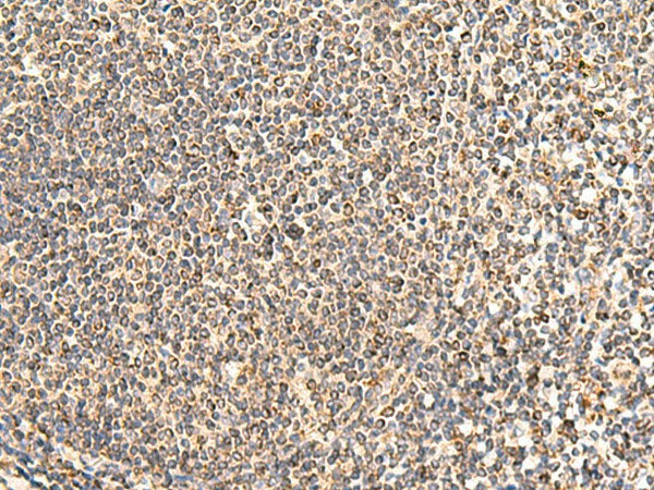 NEGR1 Polyclonal Antibody Reactivity Human