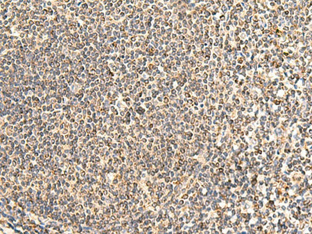 NEGR1 Polyclonal Antibody Reactivity Human