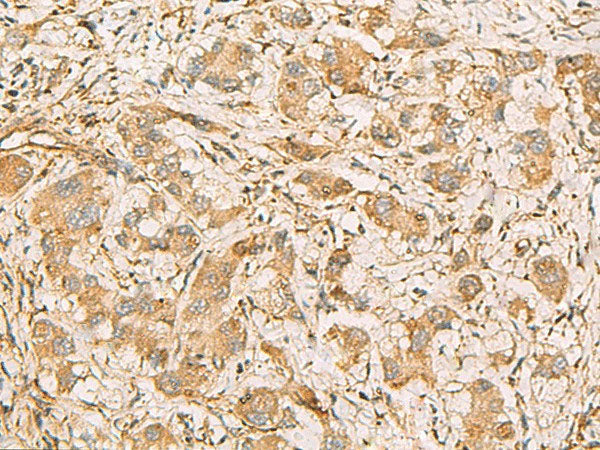 MRPS35 Polyclonal Antibody Reactivity Human
