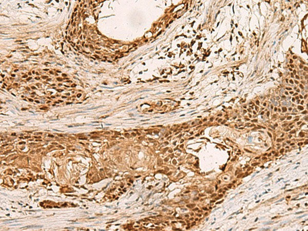 PAFAH1B2 Polyclonal Antibody Reactivity Human