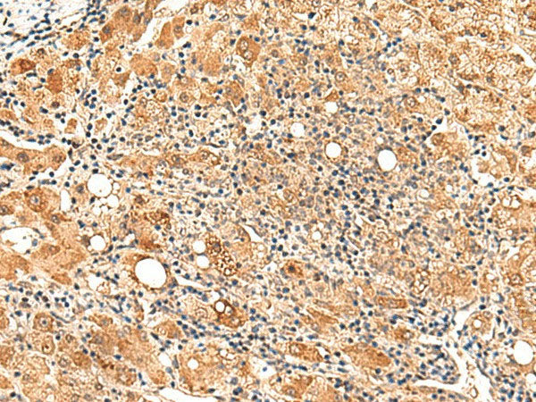 PAFAH1B2 Polyclonal Antibody Reactivity Human