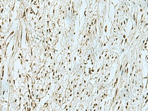 THTPA Polyclonal Antibody Reactivity Human