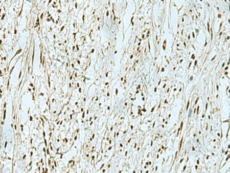 THTPA Polyclonal Antibody Reactivity Human
