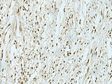 THTPA Polyclonal Antibody Reactivity Human