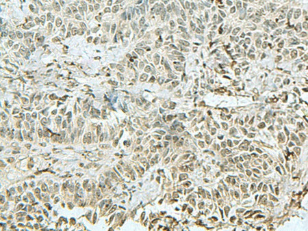 THTPA Polyclonal Antibody Reactivity Human