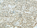 THTPA Polyclonal Antibody Reactivity Human