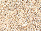SMNDC1 Polyclonal Antibody Reactivity Human