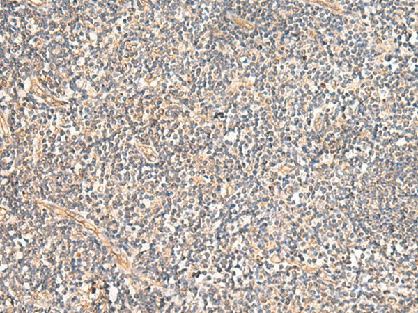MRPL16 Polyclonal Antibody Reactivity Human