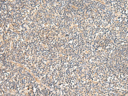 MRPL16 Polyclonal Antibody Reactivity Human