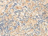 MRPL16 Polyclonal Antibody Reactivity Human