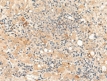 SULT4A1 Polyclonal Antibody Reactivity Human