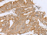 HCCS Polyclonal Antibody Reactivity Human