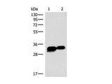 HCCS Polyclonal Antibody Reactivity Human