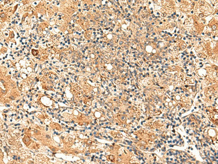 GALNT12 Polyclonal Antibody Reactivity Human