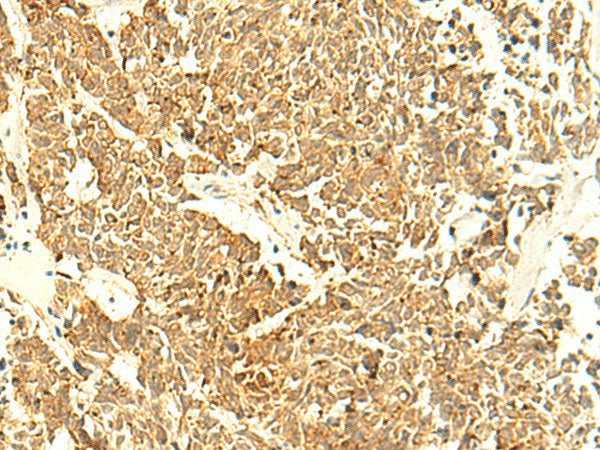 UNKL Polyclonal Antibody Reactivity Human