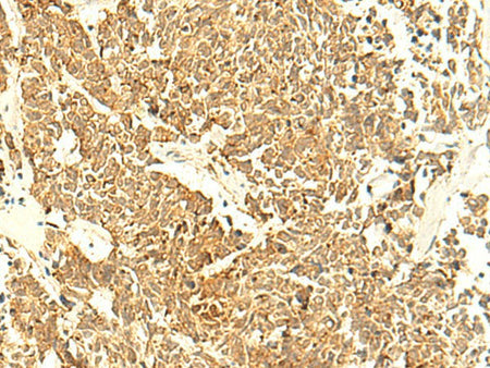 UNKL Polyclonal Antibody Reactivity Human