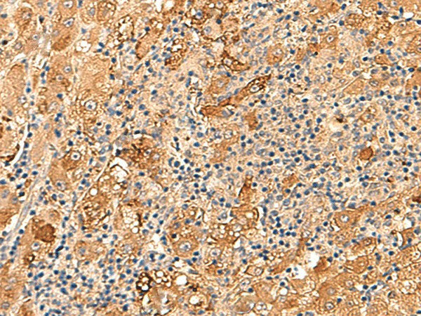 KCNE3 Polyclonal Antibody Reactivity Human