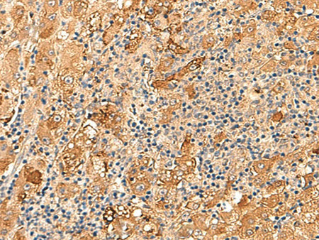KCNE3 Polyclonal Antibody Reactivity Human