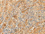 KCNE3 Polyclonal Antibody Reactivity Human